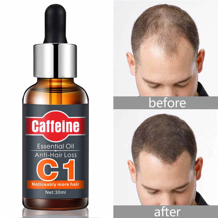 C1 Fast Hair Growth Essence Oil Anti Hair Loss Treatment Growing Hair 30ml