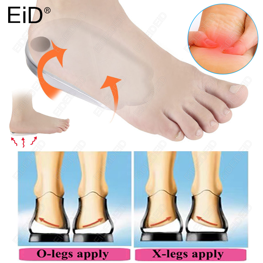 1/2 Pairs Orthopedic Insoles Self-Adhesive O/X Leg Valgus Correction Silicone Gel Magnet Massage For Men Women Heel Pad