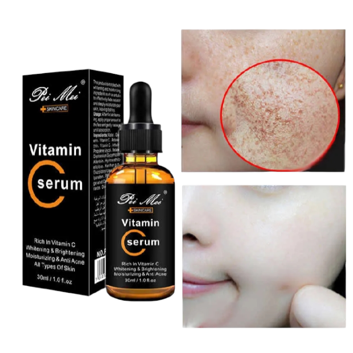 Pei Mei Vitamin C Moisturizing & Anti-Acne Face Serum - 30ml