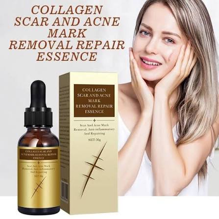 Scar Removal Cream - TCM Scar Cream for Surgical Scars, Acne Skin Care Cream, Acne Treatment Cream for Scars, Burns, Stretch Marks, Acne Spots
