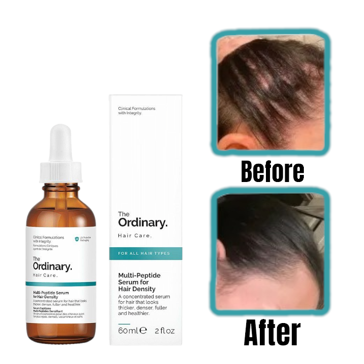 Ordinary Multi-Peptide Hair Growth Serum for Hair Density -60ml