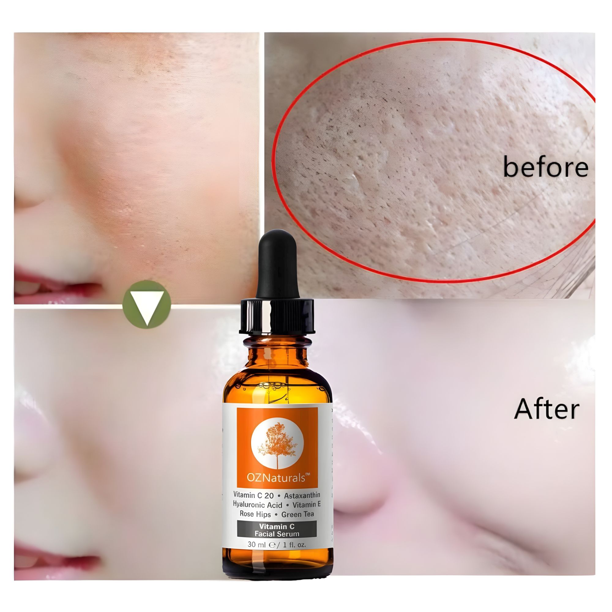 OZ Naturals Vitamin C Serum - Hydrating & Brightening with Hyaluronic Acid & Vitamin E (30ml)