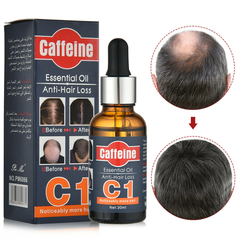 C1 Fast Hair Growth Essence Oil Anti Hair Loss Treatment Growing Hair 30ML