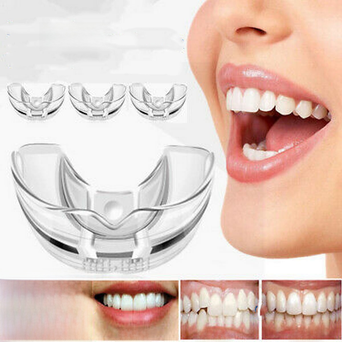 3 In 1 Orthodontic Retainer / Teeth Corrector