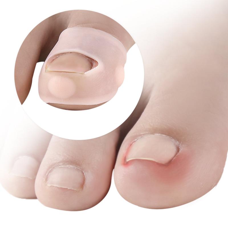 Wenefang Fashion 1/3/5PCS Ingrown Toe Nail Correction Tool Toenail Straightening Tool Repair Kit Patch Correctors Nail Care Orthosis Foot Tool