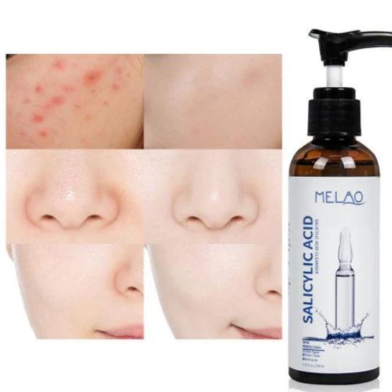 Melao Salicylic Acid Face Wash 100 ml