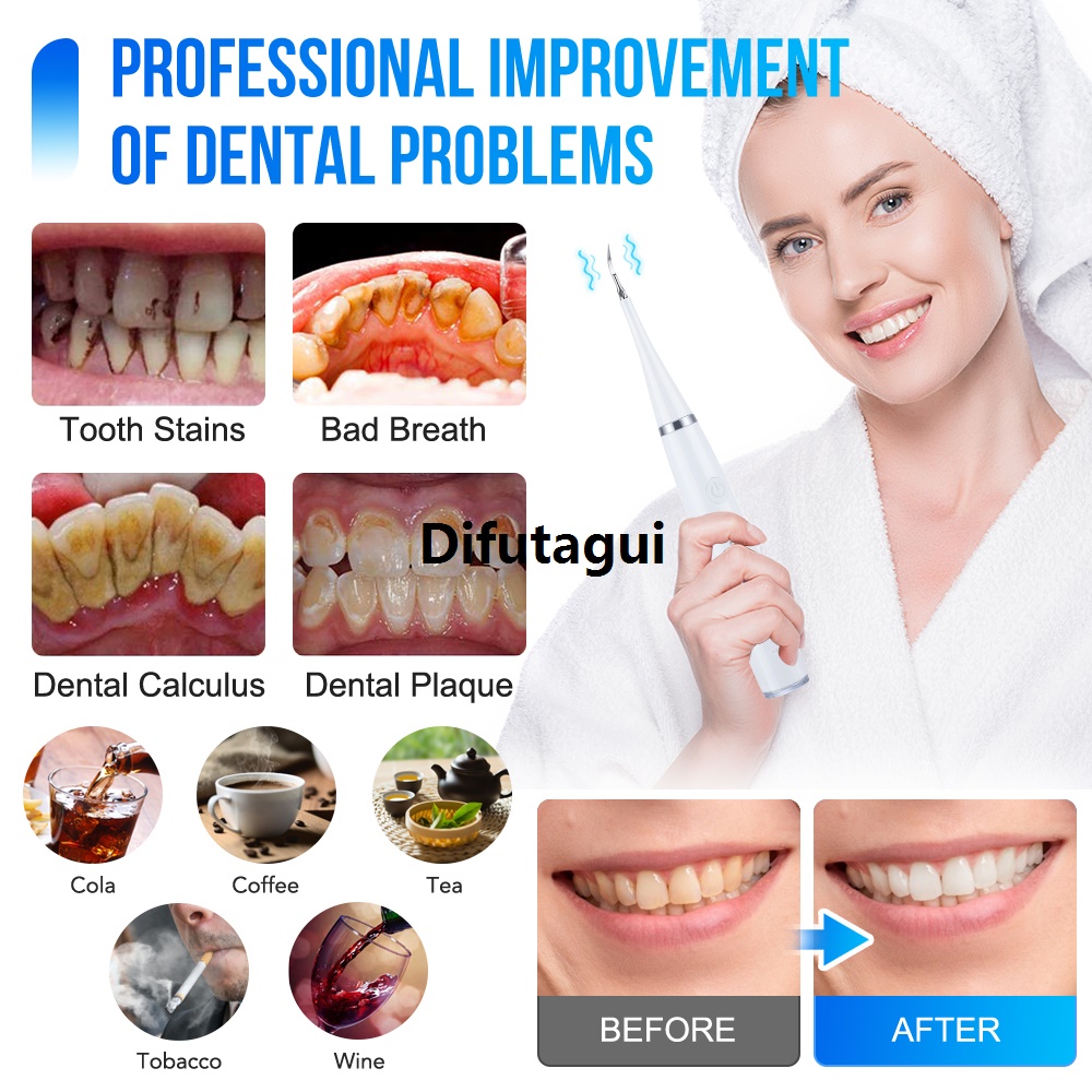 Difutagui New style New models on sale Electric Sonic Dental Scaler Calculus Remover Teeth 2025 Cleaner Dental Cleaning Teeth Whitening Toothbrush Tartar Remover Oral Care