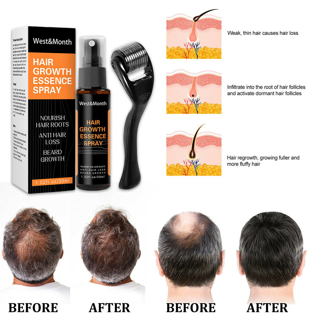 Combo 30ml Natural Hair Growth Ginger Essence Spray Anti Hair Loss Unisex With Derma Roller