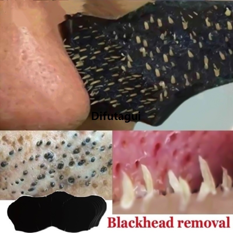 Difutagui 2025 10/20/50pcs Nose Strips For Blackheads Acne Removal Instant Special Pore Unclogging Strips Deep Cleansing Nose Clean Patch New