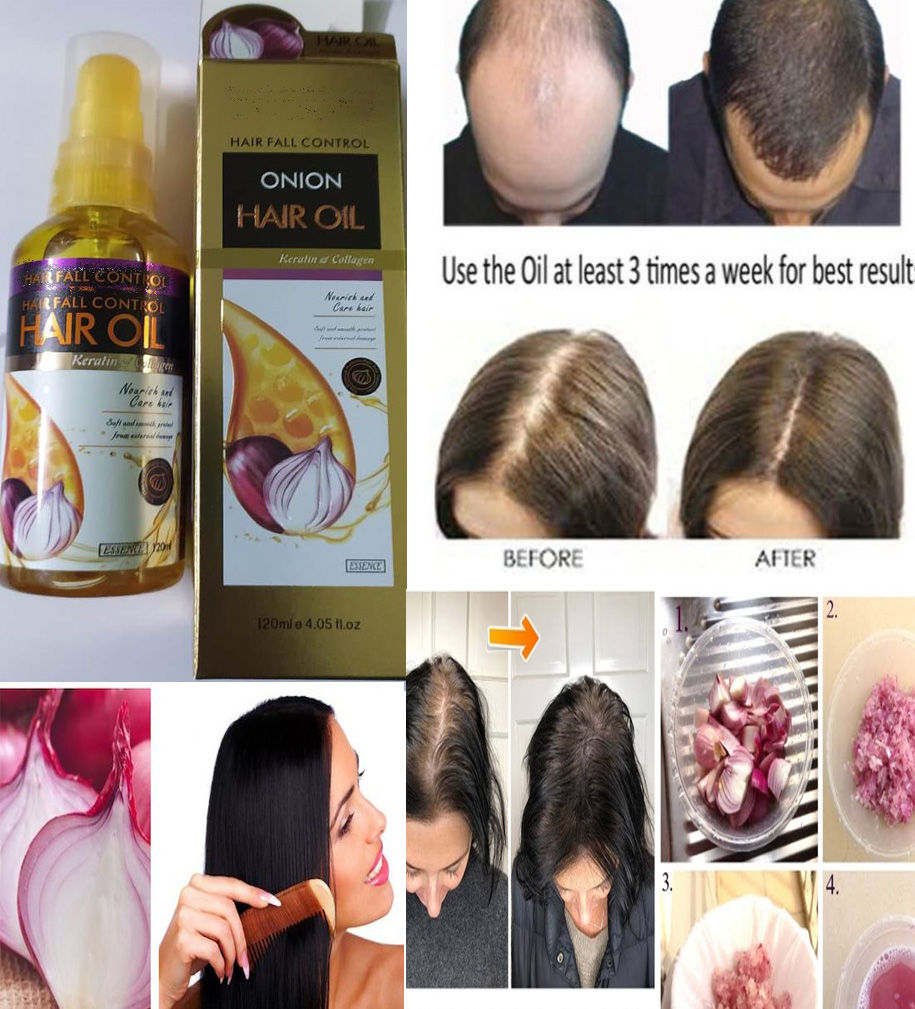 Keratin & Collagen Hair Fall Control And Damage Repair Onion Hair Oil 120ml