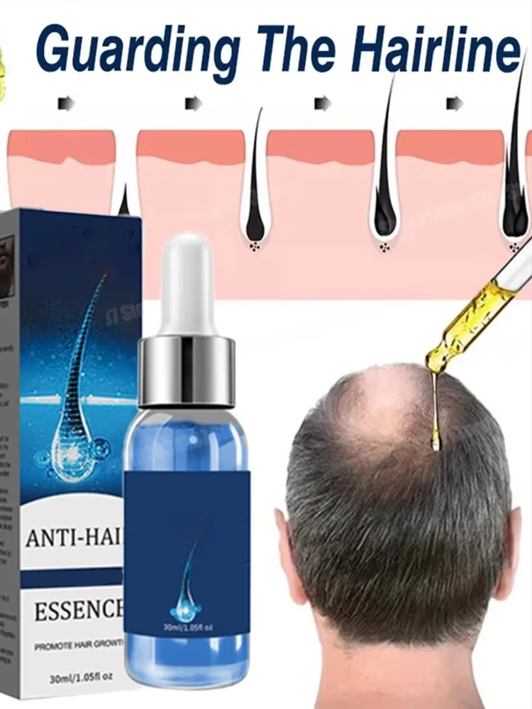Special Offer Nourish Hair for Men Women Ginger Natural Nourish Hair Oil Care Anti Hair Loss Scalp Serum