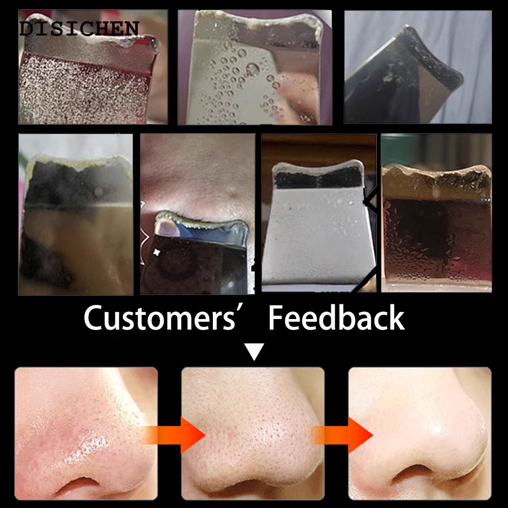 DISICHEN Sales promotion Blackhead Remover Facial Cleanser Skin Scrubber Acne Black Point Dots Tool Vibration Face Cleaning Scrub Skin Care Cosmetics