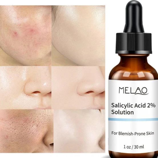 Melao Salicylic Acid Serum - 30 ML