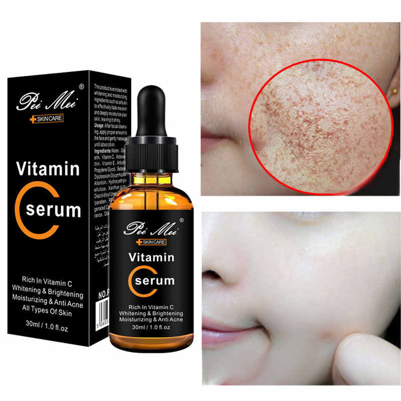 Pie Mei Hyaluronic Acid Anti-Aging Serum For Wrinkles And Acne-30ml