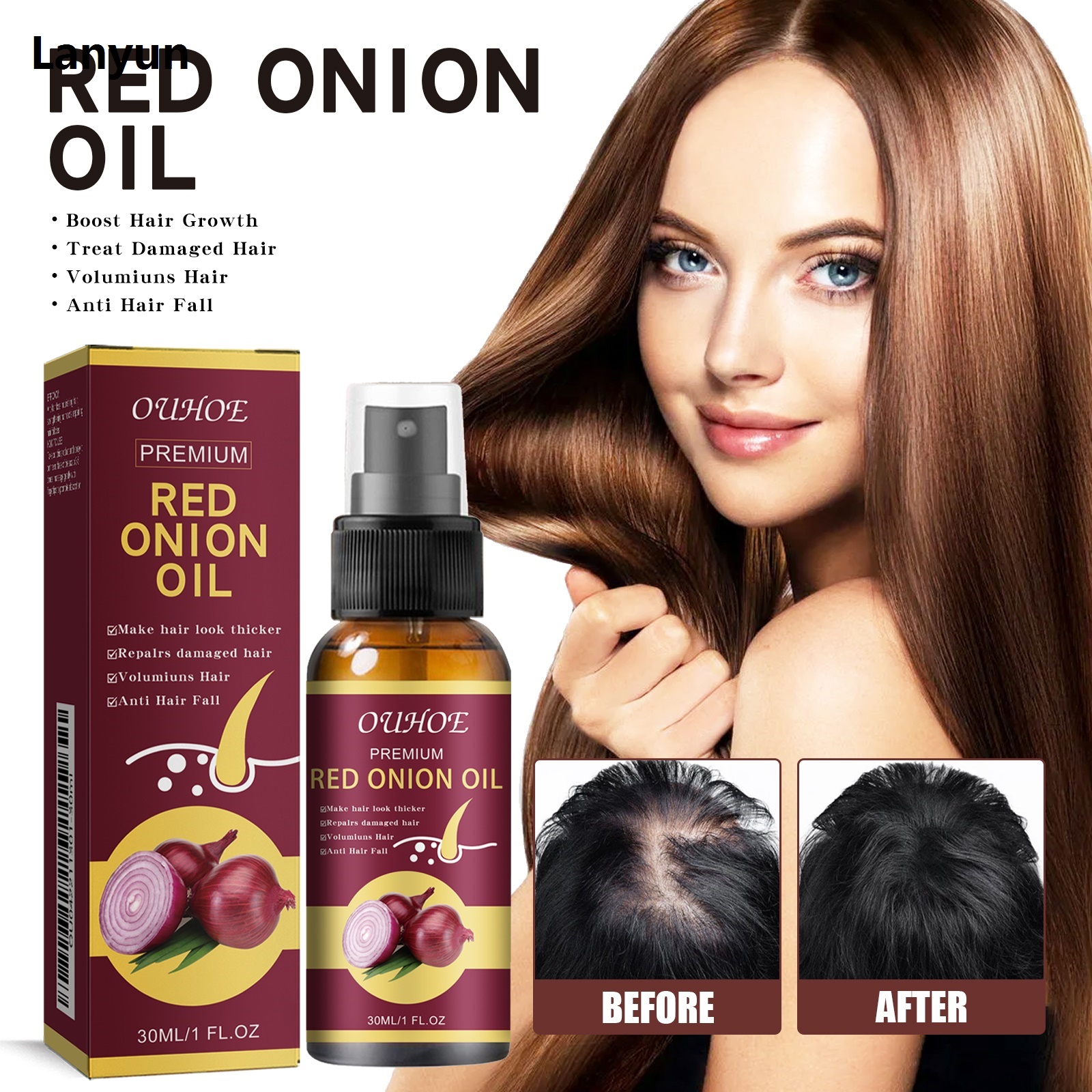 Lanyun Red Onion Hair Growth Essential Oil Hair Care Spray Prevent Hair 2025 New Loss Nourish Hair Roots Improve Hair Texture Hair Care Products