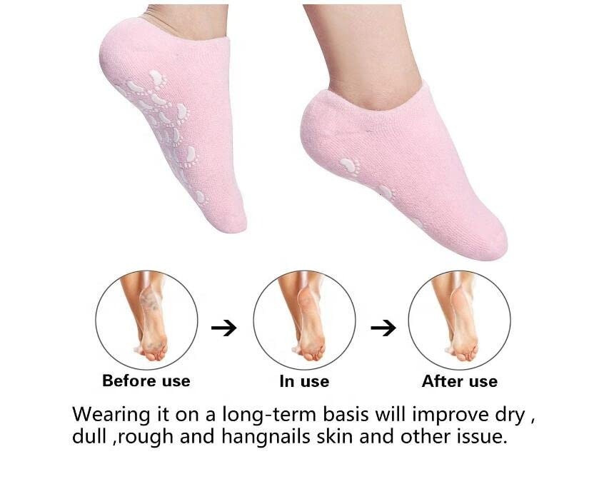 Protection Moisturizing Spa Gel Shocks | Heel Pain Relief Anti Crack Gel Foot Care Pad for Men & Women (Multicolor) 2 Pair