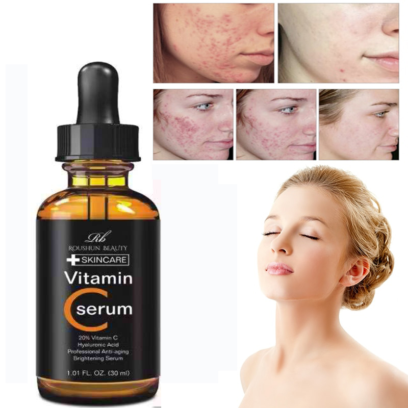 Romantic Sunday Anti Aging, Acne Control Vitamin C Serum 60ml