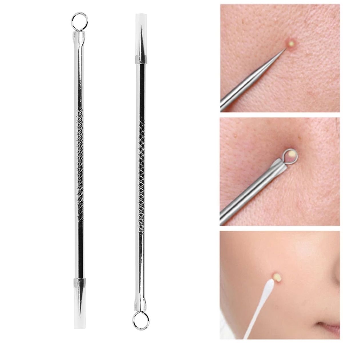 Stainless Steel Blackhead Remover Pin - 1pcs