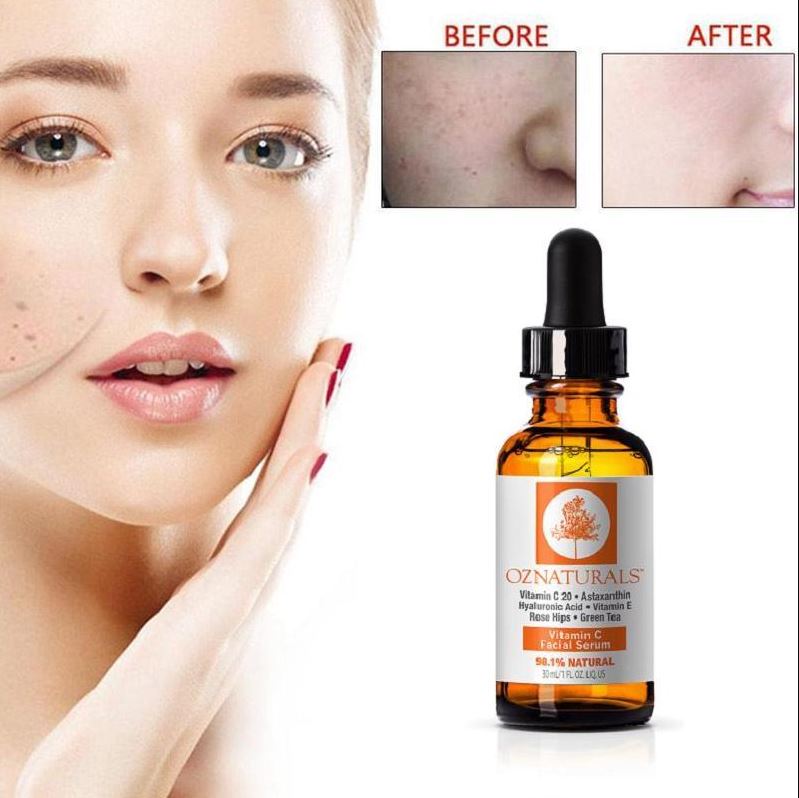 Vitamin C Serum Natures Facial Serum 30ml Natures