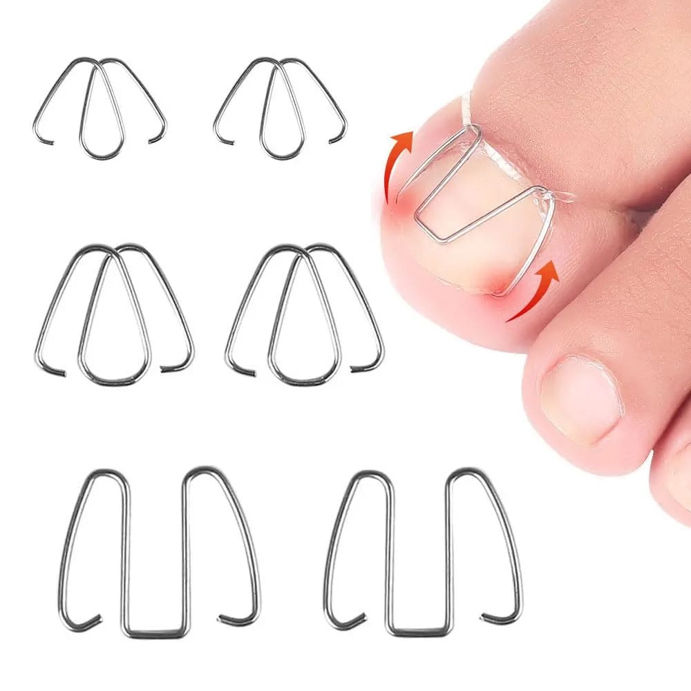 Ingrown Toenail Wire Toenail Corrector Recover Care Nail Tool Stainless Steel Ingrown Toenail Correction for Ingrown Toenails Care Curve Correct Ingrown Toenail Treatment