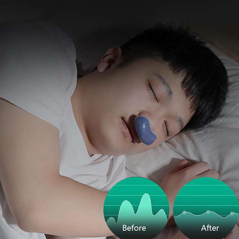 NEW 【Special offer】Electric Anti Snoring Prevention Electronic Device Sleep Stop Snore Aid Stopper