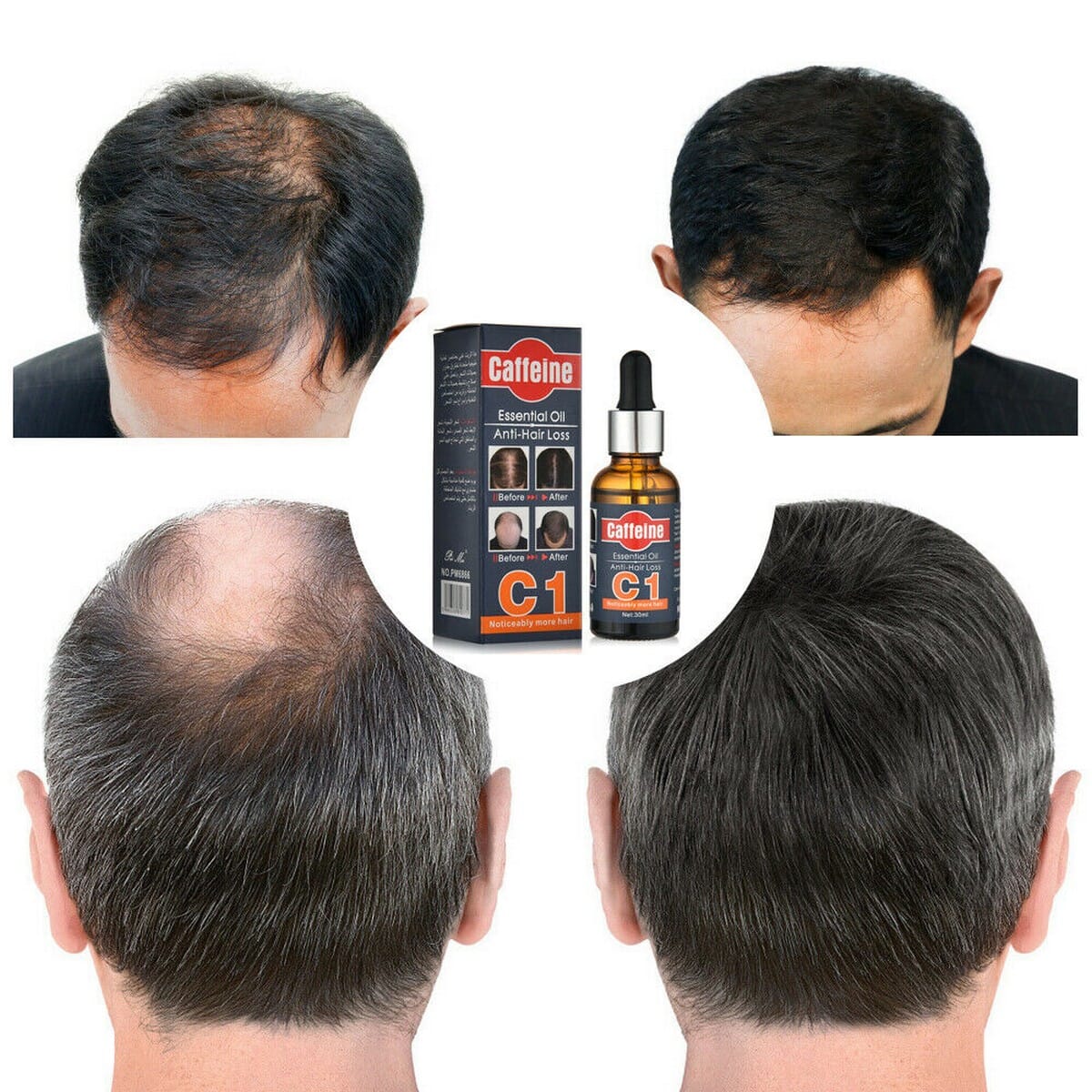 C1 Fast Hair Growth Essence Anti-Hair Loss Caffeine Essential Oil Liquid Treatment 30ml
