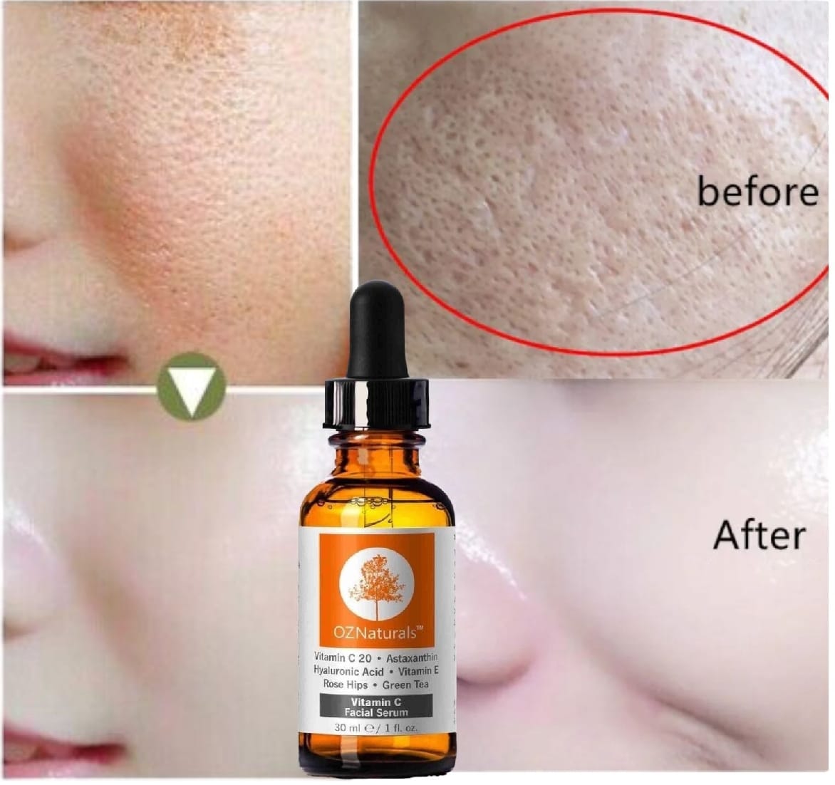 OZ Naturals Vitamin C Serum - Hydrating & Brightening with Hyaluronic Acid & Vitamin E (30ml)
