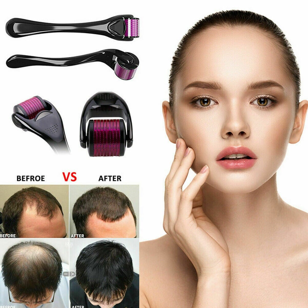 1MM Derma Roller For Hair Growth