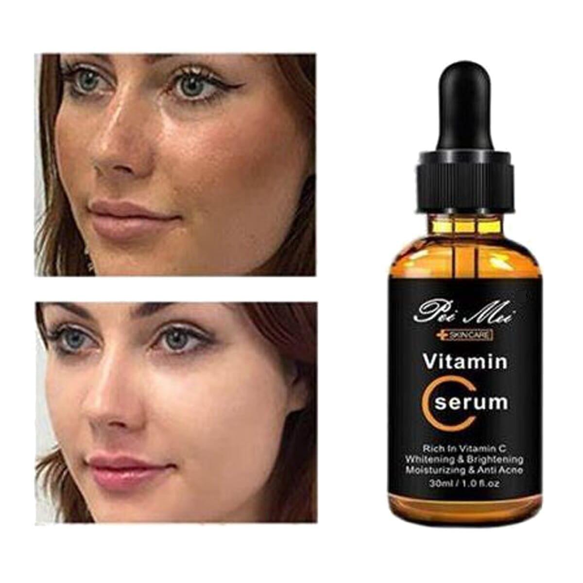 Pei Mei Vitamin C Serum for All Skin Types Brightening & Anti-Acne, 30ml