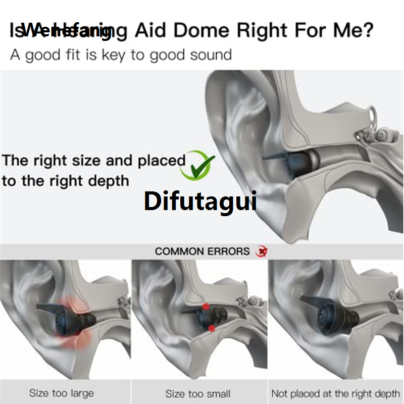 Difutagui Hearing Aid Domes for Phonak Marvel Paradise RIC BTE Luxury 2025 Models SDS 4.0 Large Open Dome 10mm 20 Pcs Pack,Large